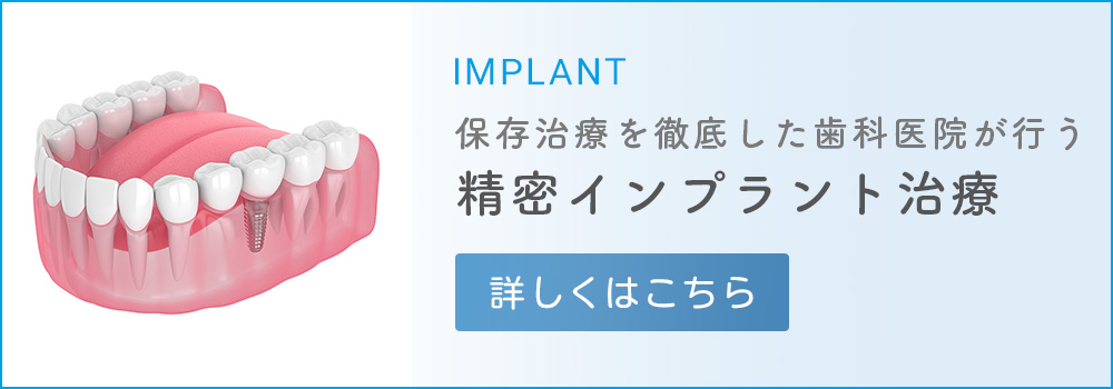 精密インプラント治療 詳しくはこちら