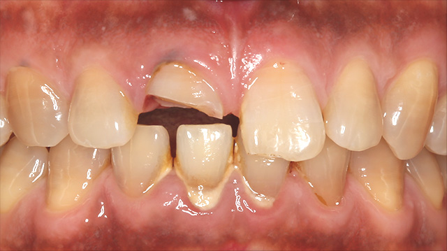 審美治療ケース