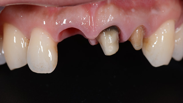 審美治療ケース