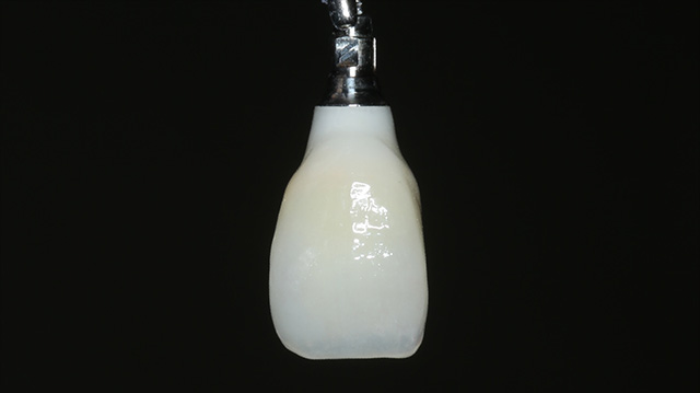 審美治療ケース