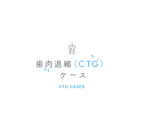 審美治療ケース