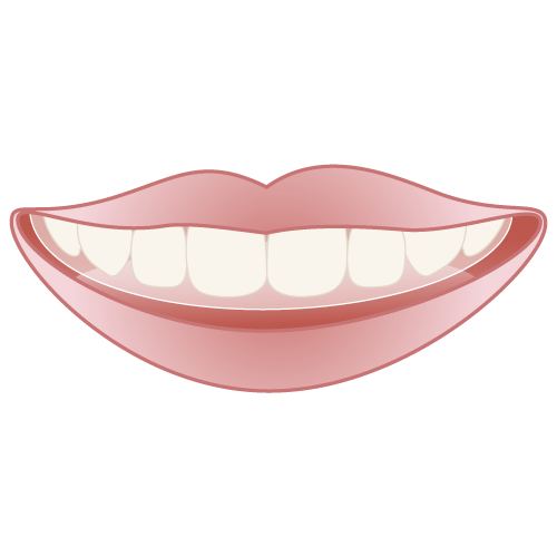 インビザライン