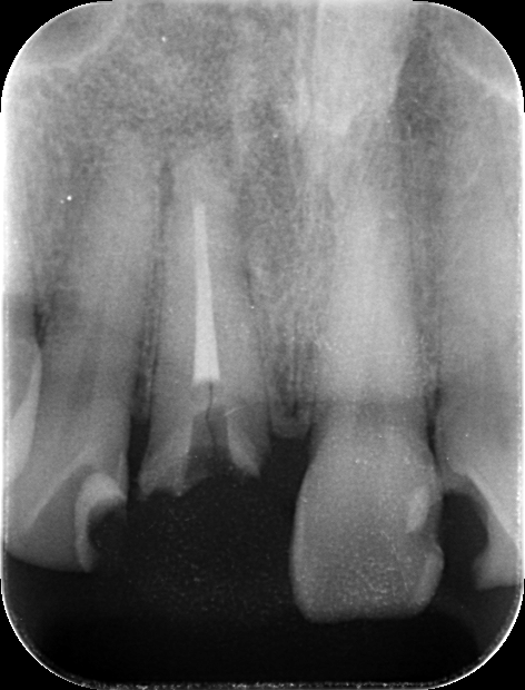 レントゲン写真