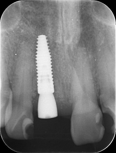 レントゲン写真