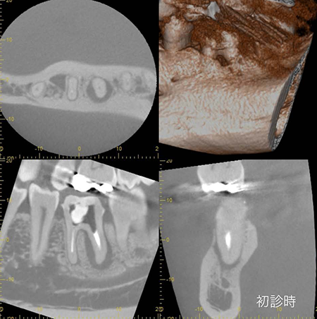 レントゲン写真