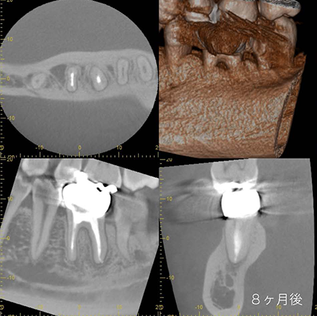 レントゲン写真
